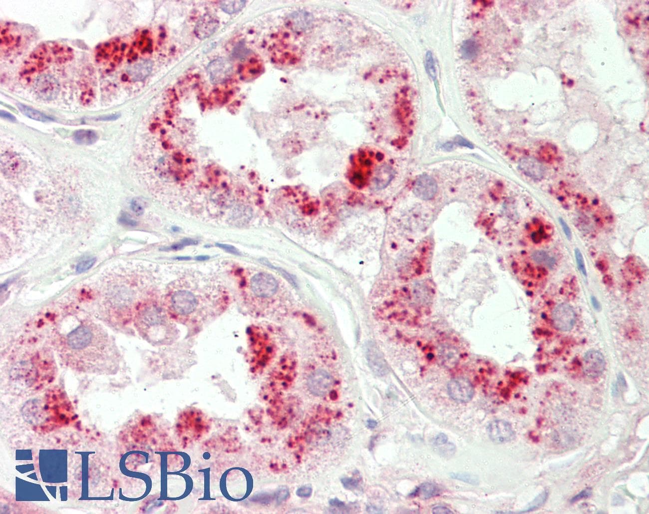 IHC-plus™ REPS1 Antibody (aa579-628)