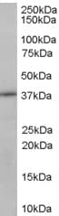 IHC-plus™ Polyclonal Goat anti-Human SORD / Sorbitol Dehydrogenase Antibody (aa345-357, IHC, WB)