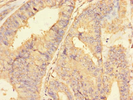 Polyclonal Rabbit anti-Human RBBP8 / CTIP Antibody (IHC)