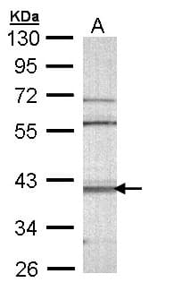 CAMK1D Antibody (aa1-385)