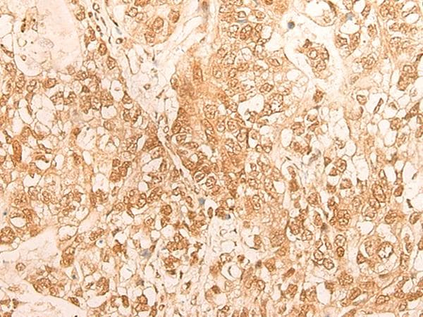 D-Binding Protein / DBP Antibody