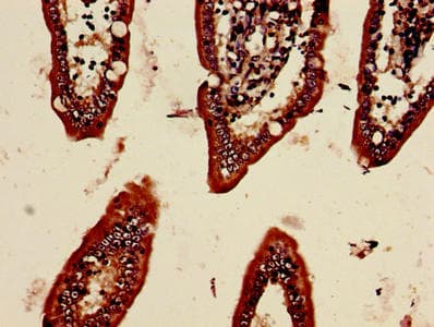 Polyclonal Rabbit anti-Human MDK / Midkine Antibody (WB)