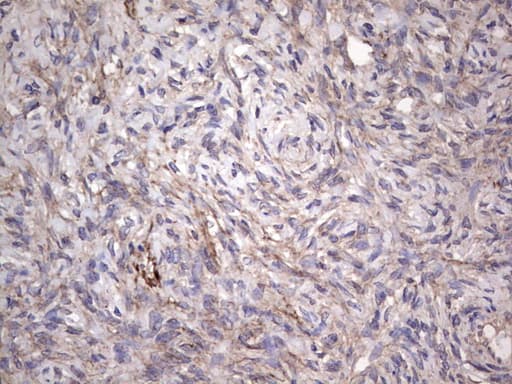 CNOT4 / CLONE243 Antibody (aa190-455, clone OTI1F10)