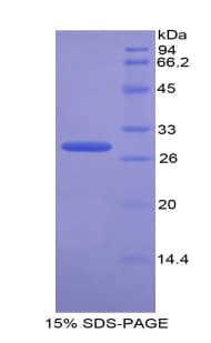 Bovine TNPO1 / Transportin 1 Protein (Recombinant His)