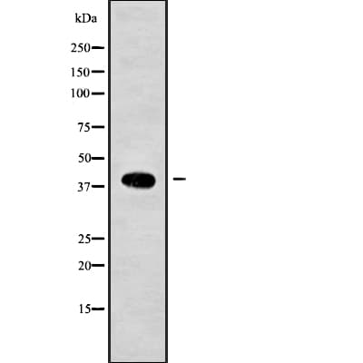 ACAA2 Antibody