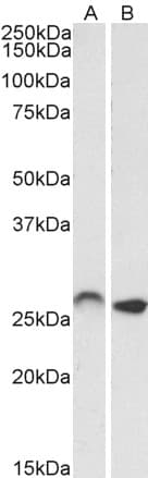 IHC-plus™ Polyclonal Goat anti-Human HOXC6 Antibody (aa22-36, IHC, WB)