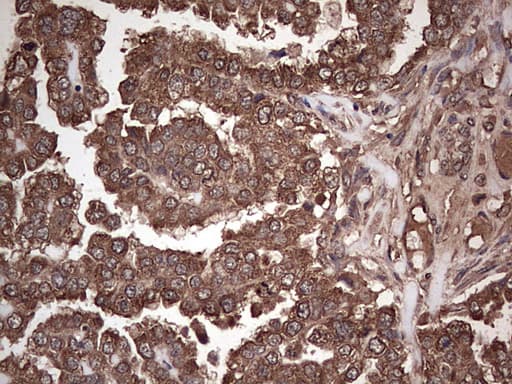 DICER1 / Dicer Antibody (aa1666-1922, clone OTI1G8)