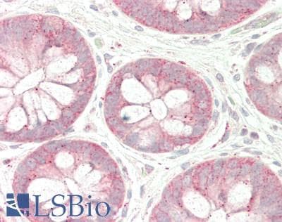 Polyclonal Rabbit anti-Human FAM175B / KIAA0157 Antibody (aa288-337, IHC, WB)