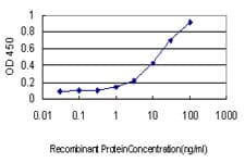 IHC-plus™ PSMB4 Antibody (clone 6G7-E8)