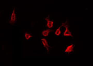 Polyclonal Rabbit anti-Human CCR5 Antibody (phospho-Ser349, IF, WB)