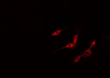 TK1 / TK / Thymidine Kinase Antibody