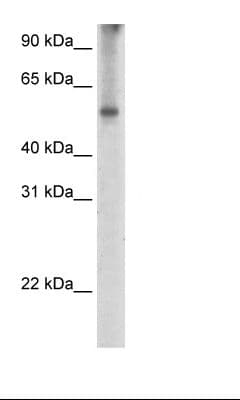 Polyclonal Rabbit anti-Human EIF2A / EIF2 Alpha Antibody (aa504-553, IHC, WB)
