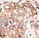 Polyclonal Rabbit anti-Human TPX2 Antibody (aa350-382, IHC, WB)