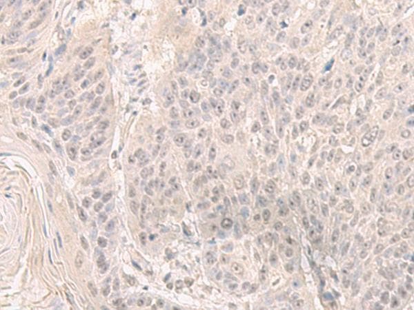 HENMT1 Antibody
