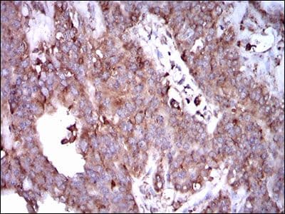 STAT5A Antibody (Amino Acid: 583-794, clone 6D4)