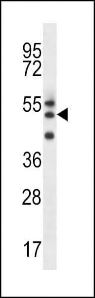 Polyclonal Rabbit anti-Human FAM82A1 Antibody (aa188-216, WB)