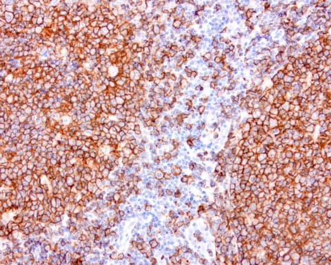 Monoclonal Mouse anti-Human CD20 Antibody (clone UMAB38, Carrier-free, IHC, WB)