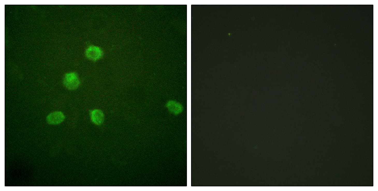 FOSB Antibody (aa12-61)