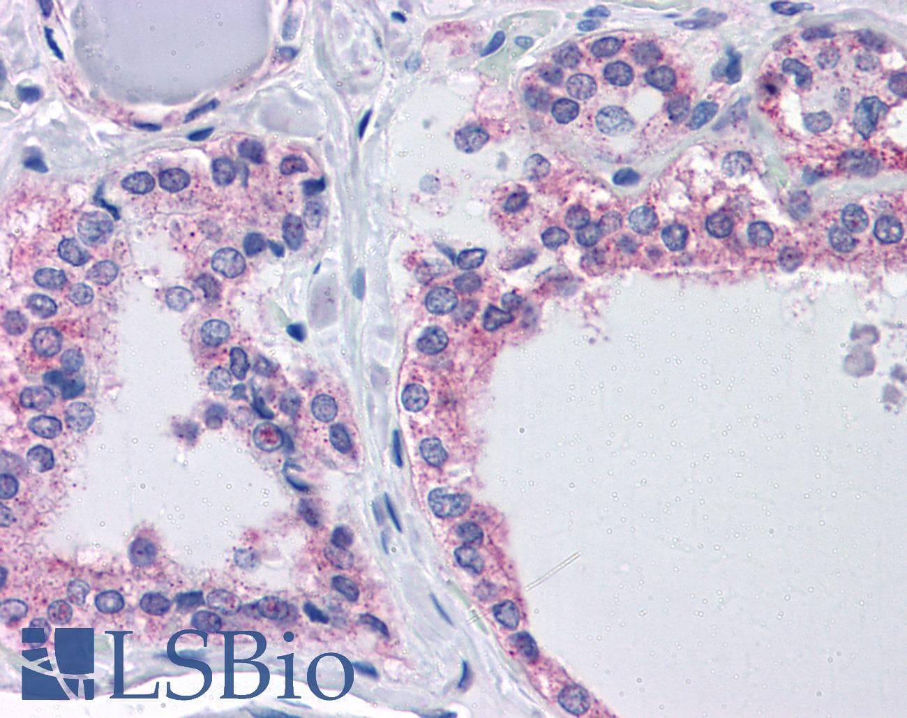IHC-plus™ AGAP2 / PIKE Antibody (aa46-60)