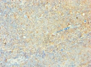 Polyclonal Rabbit anti-Human CLOCK Antibody (aa577-846, IHC, WB)