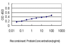 STAT1 Antibody (clone 1A8)