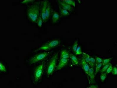 TWF1 / PTK9 Antibody