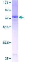 Human FDFT1 / Squalene Synthase Protein (Recombinant GST)