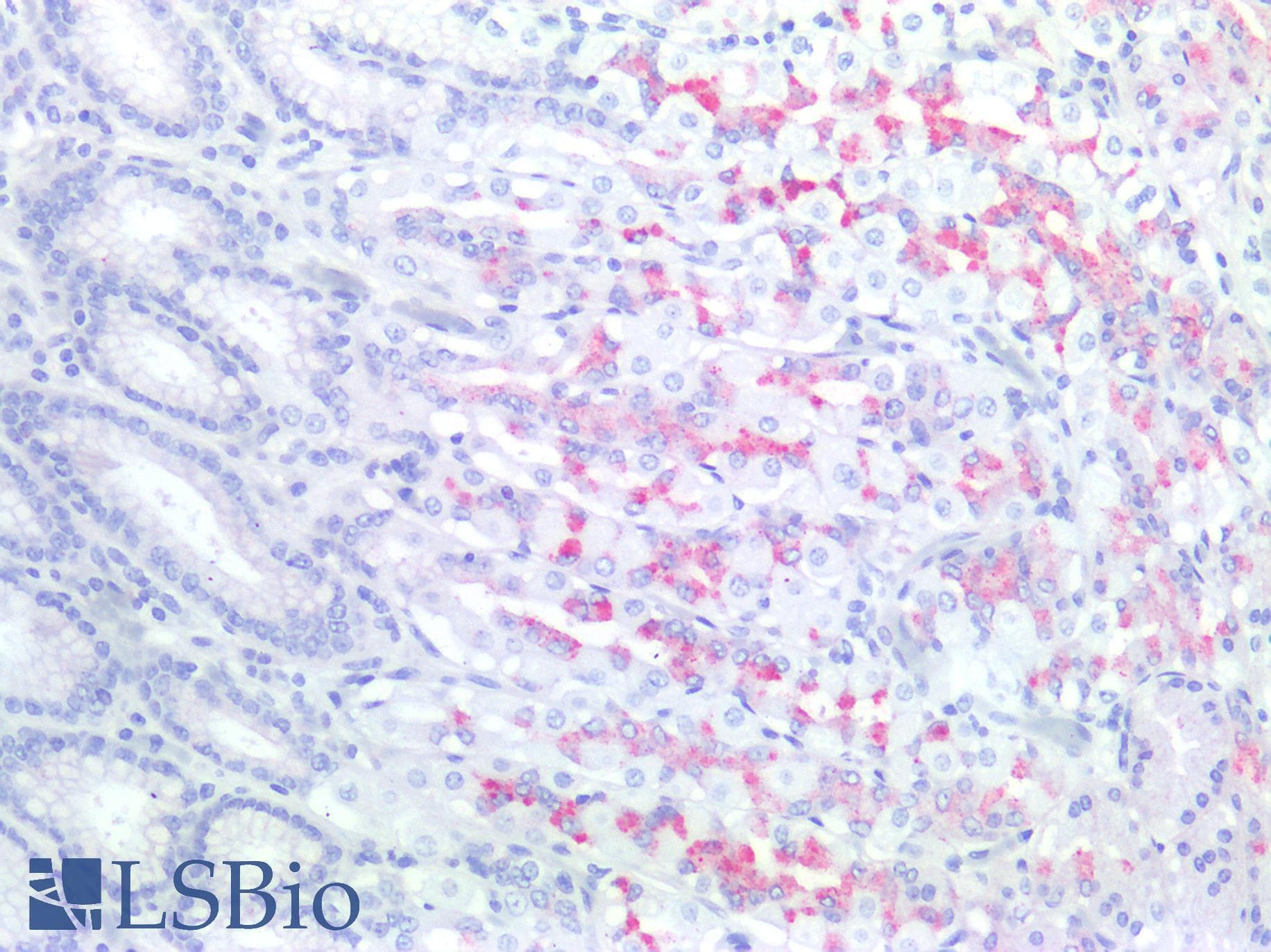 PathPlus™ Polyclonal Rabbit anti-Human MUC6 / MUC-6 Antibody (IHC)
