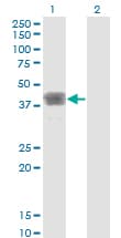MAGEB1 Antibody (clone 2A4)