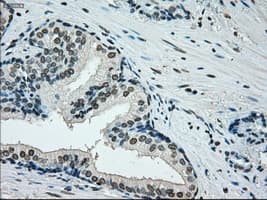 ERCC1 Antibody (clone OTI1A3)