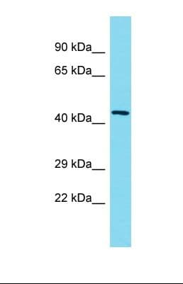 NSMCE4A / NSE4A Antibody (aa240-289)