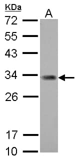 Polyclonal Rabbit anti-Human ING5 Antibody (aa46-142, WB)