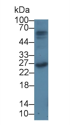F2 / Prothrombin / Thrombin Antibody (aa44-200)