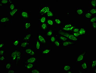 Polyclonal Rabbit anti-Human HIST1H3A Antibody (phospho-Thr80, IF)