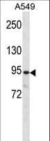 PKP3 / Plakophilin 3 Antibody (aa766-794)