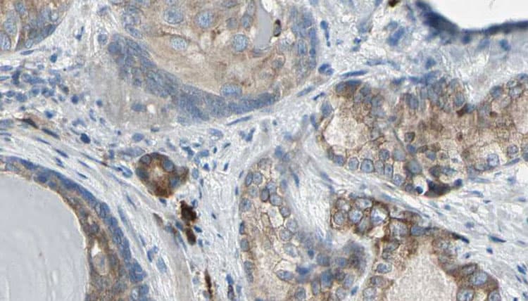 KCNK15 Antibody