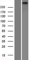 TECTA Protein (Over-Expression Lysate Myc-DDK (Flag))