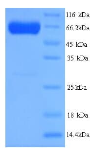 Human PKLR Protein (Recombinant His)