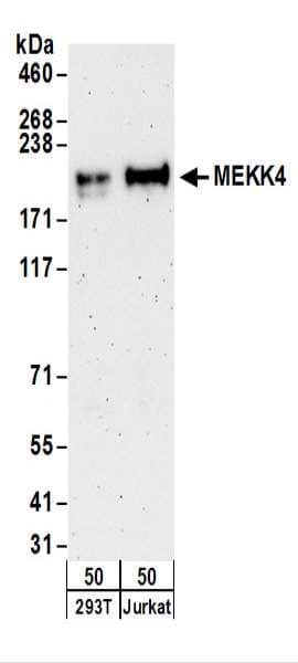 Polyclonal Rabbit anti-Human MAP3K4 / MEKK4 Antibody (aa75-125, WB)