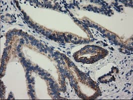 RASD2 Antibody (clone OTI1F7)