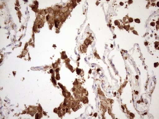 Monoclonal Mouse anti-Human P40PHOX / NCF4 Antibody (clone OTI4B5, Carrier-free, IHC, WB)