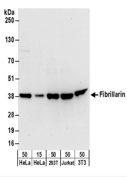 IHC-plus™ Polyclonal Rabbit anti-Human FBL / FIB / Fibrillarin Antibody (aa271-321, IHC, WB)