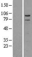 TPX2 Protein (Over-Expression Lysate Myc-DDK (Flag))