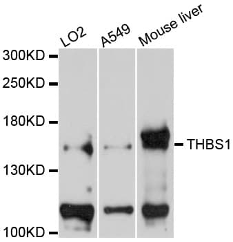 THBS1 / Thrombospondin-1 Antibody