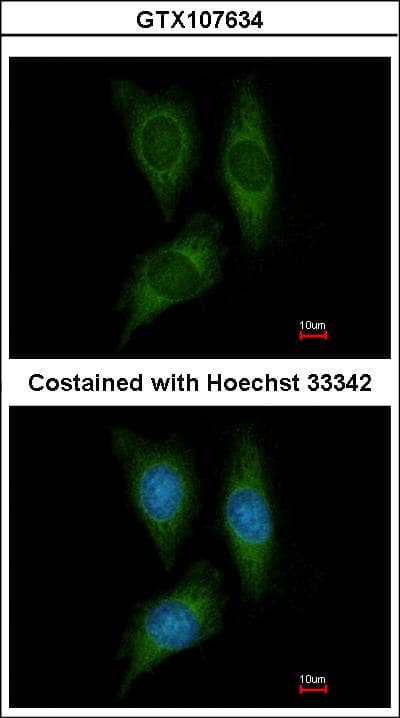 Polyclonal Rabbit anti-Human STK25 Antibody (aa1-231, IHC, WB)