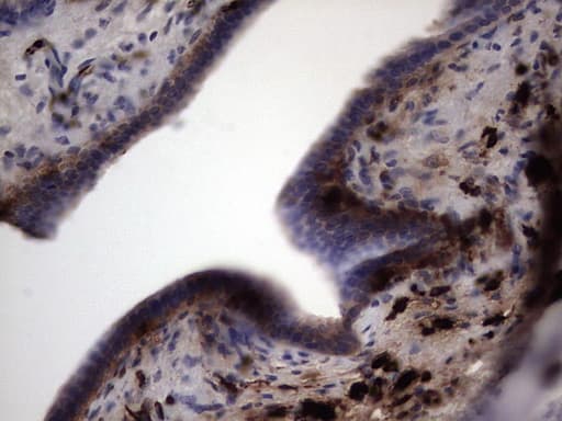 S100A9 / MRP14 Antibody (clone OTI8C2)