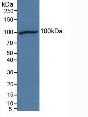 CDH2 / N Cadherin Antibody (aa45-238)