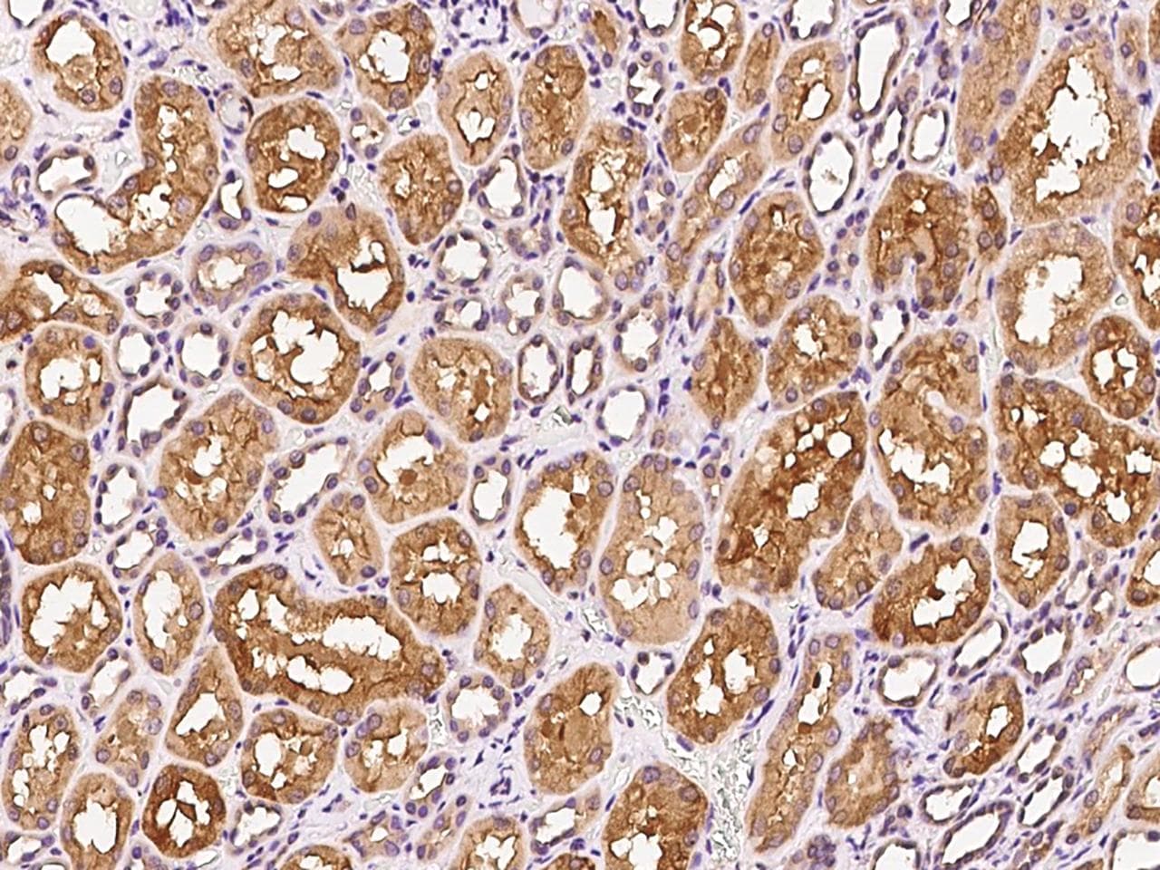 ICMT / PPMT Antibody