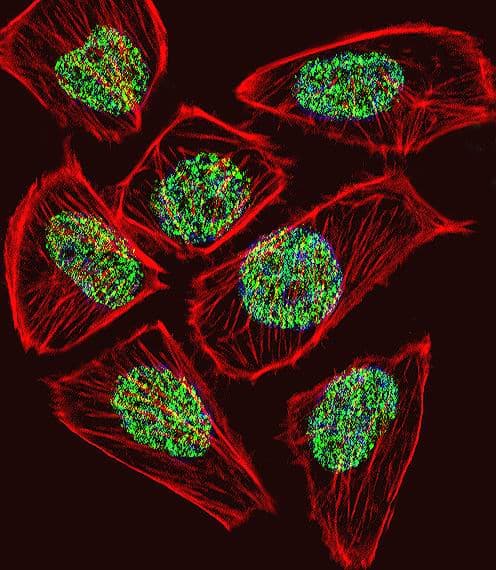 TADA3 / ADA3 Antibody (aa386-414)