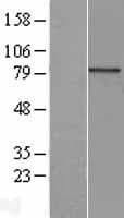 Human AOC2 / SSAO Protein (Over-Expression Lysate Myc-DDK (Flag))